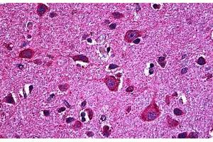 Human Brain, Cortex: Formalin-Fixed, Paraffin-Embedded (FFPE) (EPH Receptor B6 抗体  (AA 23-122))