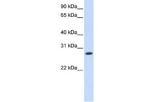 HSD11B1 antibody used at 1 ug/ml to detect target protein. (HSD11B1 抗体)