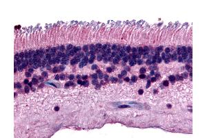 Immunohistochemistry (IHC) image for anti-Protein Tyrosine Phosphatase, Receptor Type, M (PTPRM) (Internal Region) antibody (ABIN1049277)