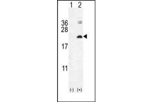 Western blot analysis of IL17F (arrow) using rabbit polyclonal IL17F Antibody (N-term) (ABIN654914 and ABIN2844560). (IL17F 抗体  (N-Term))