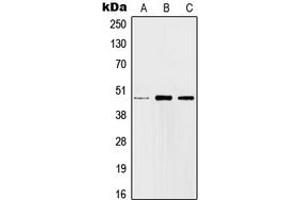 Western blot analysis of c-Jun expression in HEK293T (A), SP2/0 (B), H9C2 (C) whole cell lysates. (C-JUN 抗体  (Center))