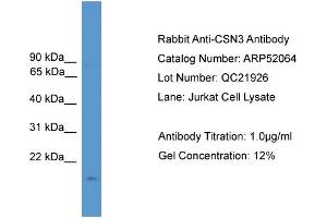WB Suggested Anti-CSN3  Antibody Titration: 0. (CSN3 抗体  (N-Term))