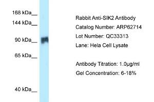 Western Blotting (WB) image for anti-Salt-Inducible Kinase 2 (SIK2) (N-Term) antibody (ABIN2789222) (SIK2 抗体  (N-Term))