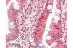 Anti-HDAC9 antibody IHC staining of human small intestine.