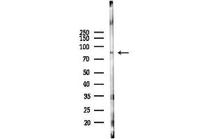 anti-Erythrocyte Membrane Protein Band 4.1 (Elliptocytosis 1, RH-Linked) (EPB41) (Internal Region) antibody