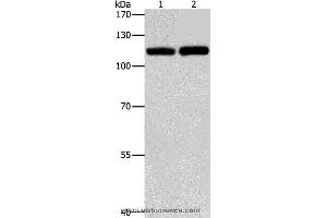 Western blot analysis of Raji and K562 cell, using TLR3 Polyclonal Antibody at dilution of 1:500 (TLR3 抗体)