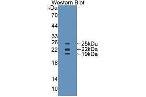 WB of Protein Standard: different control antibodies  against Highly purified E. (Catalase ELISA 试剂盒)