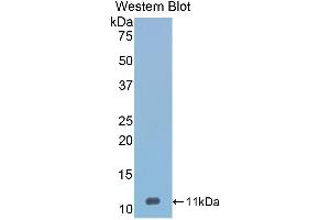 Western Blotting (WB) image for anti-serpin Peptidase Inhibitor, Clade A (Alpha-1 Antiproteinase, Antitrypsin), Member 12 (SERPINA12) (AA 71-148) antibody (ABIN3208032) (SERPINA12 抗体  (AA 71-148))