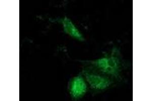 Anti-ACAT2 mouse monoclonal antibody (ABIN2453825) immunofluorescent staining of COS7 cells transiently transfected by pCMV6-ENTRY ACAT2 (RC201821). (ACAT2 抗体)