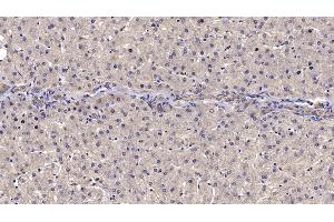 Detection of RELN in Human Liver Tissue using Monoclonal Antibody to Reelin (RELN) (Reelin 抗体  (AA 26-190))