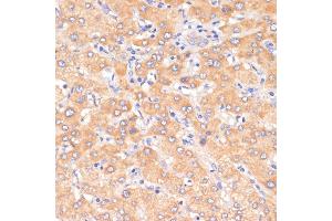 Immunohistochemistry of paraffin-embedded human liver using PDCD2L antibody (ABIN6130653, ABIN6145336, ABIN6145337 and ABIN6223261) at dilution of 1:100 (40x lens). (PDCD2L 抗体  (AA 1-358))