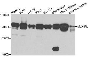 Western blot analysis of extracts of various cell lines, using MLXIPL antibody. (MLXIPL 抗体  (AA 17-175))