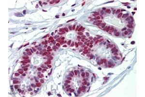 FUS antibody was used for immunohistochemistry at a concentration of 5. (FUS 抗体  (N-Term))