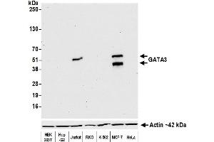 Western Blotting (WB) image for anti-GATA Binding Protein 3 (GATA3) (AA 150-200) antibody (ABIN7455153) (Recombinant GATA3 抗体  (AA 150-200))