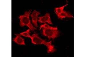 ABIN6276209 staining Hela by IF/ICC. (QRFPR 抗体  (Internal Region))