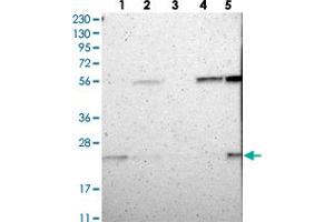 Western blot analysis of Lane 1: RT-4, Lane 2: U-251 MG, Lane 3: Human Plasma, Lane 4: Liver, Lane 5: Tonsil with FAM213B polyclonal antibody . (C1orf93 抗体)