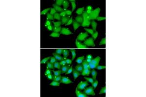 Immunofluorescence analysis of A549 cells using UBASH3B antibody (ABIN5974296). (UBASH3B 抗体)