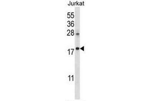 KRTAP25-1 Antibody (C-term) western blot analysis in Jurkat cell line lysates (35µg/lane). (KRTAP25-1 抗体  (C-Term))