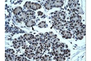 Image no. 1 for anti-Transmembrane Phosphatase with Tensin Homology (TPTE) (AA 461-510) antibody (ABIN202467) (TPTE 抗体  (AA 461-510))
