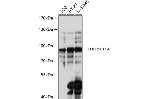 Western blot analysis of extracts of various cell lines, using TNFRSF11A antibody (ABIN6127589, ABIN6149310, ABIN6149312 and ABIN6217357) at 1:3000 dilution. (TNFRSF11A 抗体  (AA 466-616))