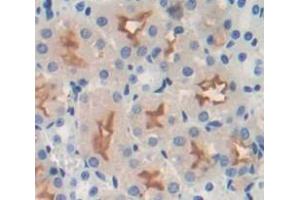 Used in DAB staining on fromalin fixed paraffin- embedded kidney tissue (Integrin beta 4 抗体  (AA 1098-1356))