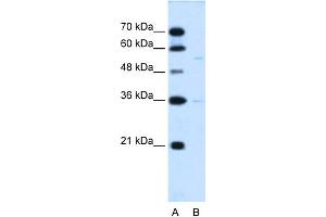 WB Suggested Anti-C19orf28 Antibody Titration:  0. (C19orf28 抗体  (Middle Region))
