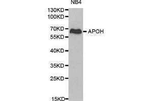 Western blot analysis of NB4 cell lysate using APOH antibody. (APOH 抗体  (AA 21-345))