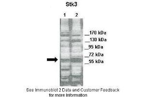 Lanes:   Lane 1: 30ug of HeLa cell lysate Lane 2: 30ug of 293T cell lysate  Primary Antibody Dilution:   1:2000  Secondary Antibody:   Anti-rabbit-HRP  Secondary Antibody Dilution:   1:5000  Gene Name:   STK3  Submitted by:   Jixin Dong & Yuanhong Chen,University of Nebraska (STK3 抗体  (N-Term))