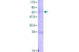 PDSS1 Protein (AA 1-306) (GST tag)