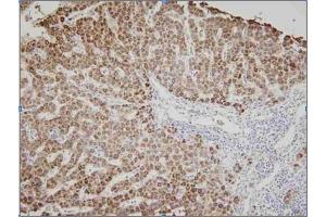 Human liver tissue was initrocelluloseubated with anti-human Ak3 (1:100) for 2 hours at room temperature. (Adenylate Kinase 3 抗体)