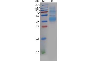 Clusterin (CLU) (AA 23-449) protein (His tag)