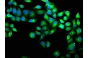 Immunofluorescence staining of Hela cells with ABIN7146372 at 1:100, counter-stained with DAPI. (CAB39 抗体  (AA 28-290))