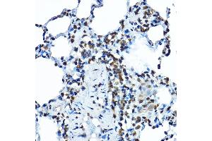 Immunohistochemistry of paraffin-embedded rat lung using BOP1 Rabbit pAb (ABIN7265887) at dilution of 1:100 (40x lens). (BOP1 抗体  (AA 600-680))