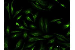 Immunofluorescence of monoclonal antibody to TAGLN on HeLa cell. (Transgelin 抗体  (AA 1-201))