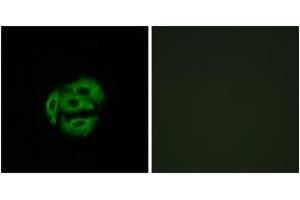 Immunofluorescence (IF) image for anti-Cytochrome P450, Family 39, Subfamily A, Polypeptide 1 (CYP39A1) (AA 361-410) antibody (ABIN1534395)