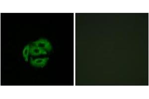 Immunofluorescence analysis of A549 cells, using Cytochrome P450 39A1 Antibody.