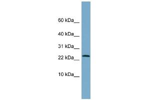 WB Suggested Anti-LRRC20 Antibody Titration: 0. (LRRC20 抗体  (Middle Region))