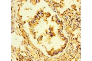 Immunohistochemistry of paraffin-embedded human lung tissue using ABIN7164777 at dilution of 1:100 (LEPREL1 抗体  (AA 301-528))