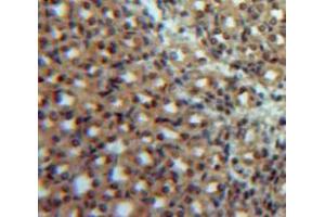Used in DAB staining on fromalin fixed paraffin-embedded Kidney tissue (IL12B 抗体  (AA 35-302))