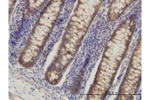 Immunoperoxidase of monoclonal antibody to HADHSC on formalin-fixed paraffin-embedded human colon. (HADH 抗体  (AA 205-314))