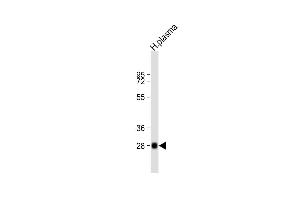Anti-CFD Antibody (N-term) at 1:2000 dilution + human plasma lysate Lysates/proteins at 20 μg per lane. (Adipsin 抗体  (N-Term))