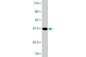 Western Blot detection against Immunogen (47. (MYL3/CMLC1 抗体  (AA 1-195))