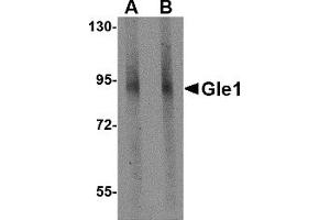 Western Blotting (WB) image for anti-GLE1 RNA Export Mediator (GLE1) (C-Term) antibody (ABIN1030413) (GLE1 抗体  (C-Term))