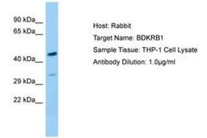 Image no. 1 for anti-Bradykinin Receptor B1 (BDKRB1) (AA 230-279) antibody (ABIN6749995) (BDKRB1 抗体  (AA 230-279))