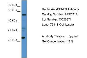 WB Suggested Anti-CPNE9  Antibody Titration: 0. (CPNE9 抗体  (C-Term))