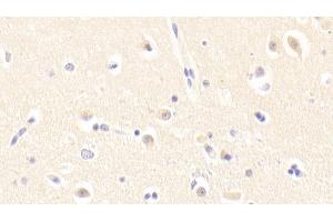Detection of GTF2H5 in Human Cerebrum Tissue using Polyclonal Antibody to General Transcription Factor IIH, Polypeptide 5 (GTF2H5)