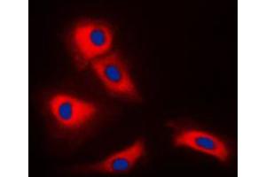 Immunofluorescent analysis of TRAF3 staining in HeLa cells. (TRAF3 抗体  (Center))