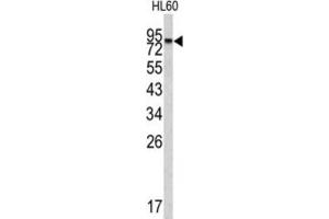 Western Blotting (WB) image for anti-Carboxypeptidase X (M14 Family), Member 2 (CPXM2) antibody (ABIN3002685) (CPXM2 抗体)
