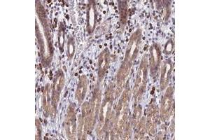 Immunohistochemical staining of human stomach with PPP1R26 polyclonal antibody  shows moderate cytoplasmic positivity in glandular cells. (PPP1R26 抗体)
