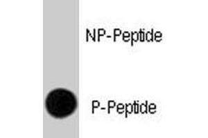 Dot blot analysis of ERBB2 (phospho Y1248) polyclonal antibody  on nitrocellulose membrane. (ErbB2/Her2 抗体  (pTyr1248))